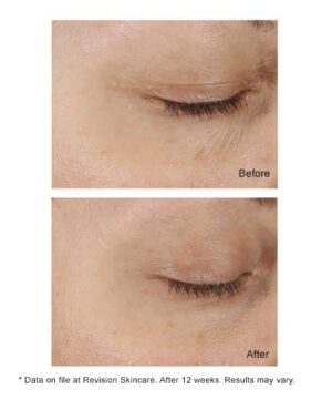 DEJ Eye Cream results