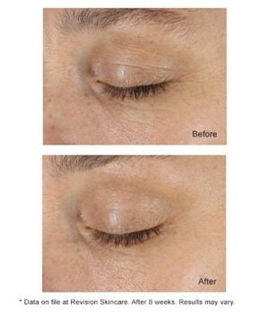 DEJ Eye Cream results