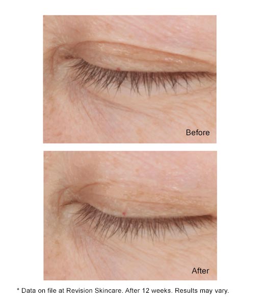 DEJ Eye Cream before and after