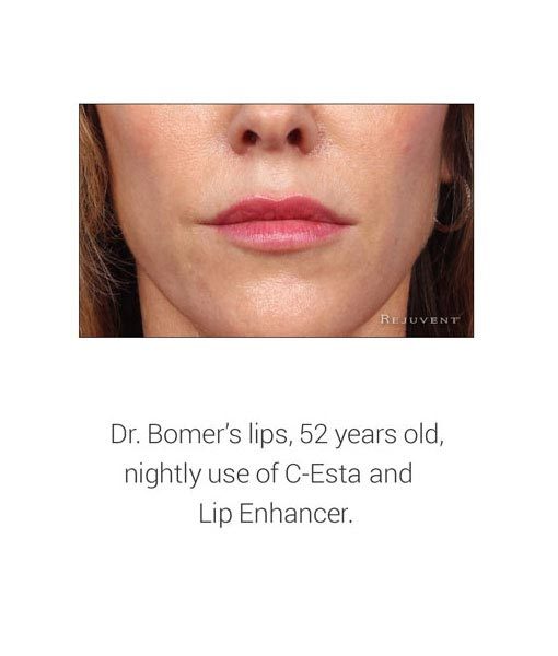 Dr Bomer's lips with her Lip Treatment