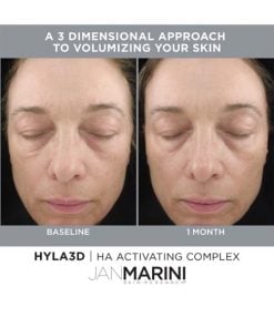 Hyla3D Before and After