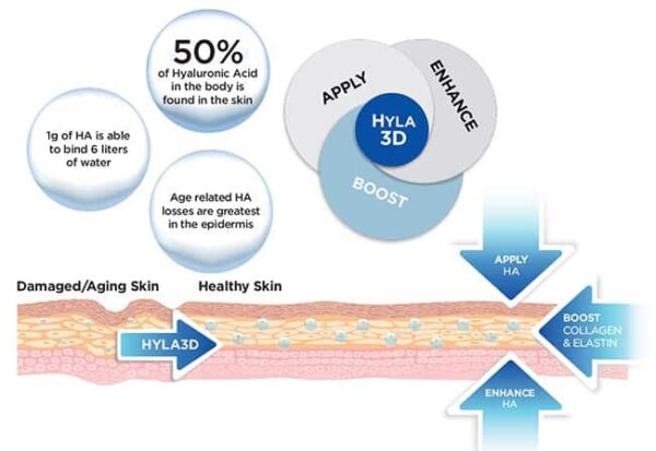 How Hyla3D works