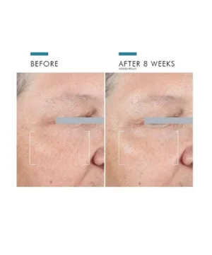 AGE Advanced Eye Cream results