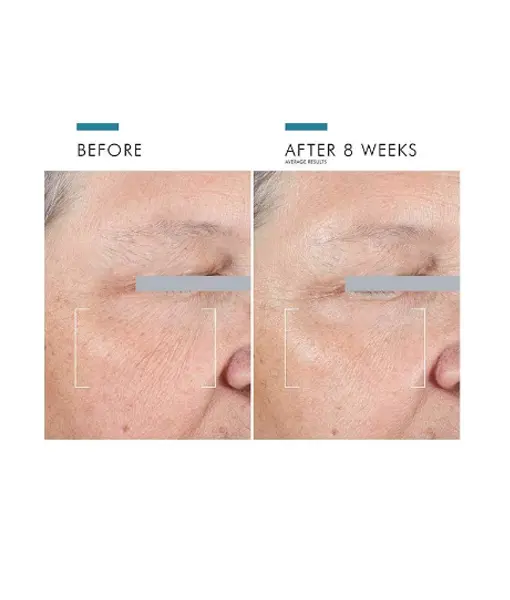 AGE Advanced Eye Cream results