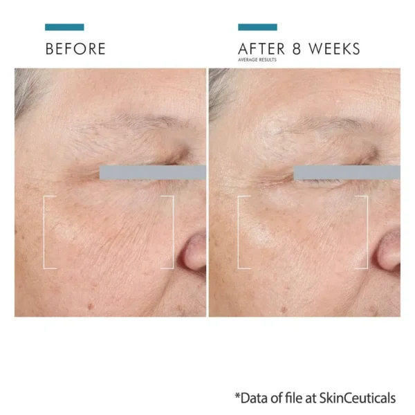 SkinCeuticals AGE Advanced Eye for dark circles results show fewer wrinkles under eyes