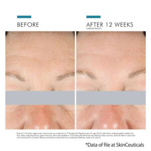 SkinCeuticals AGE Interrupter Advanced for aging results