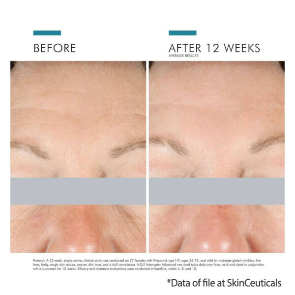 SkinCeuticals AGE Interrupter Advanced for aging results