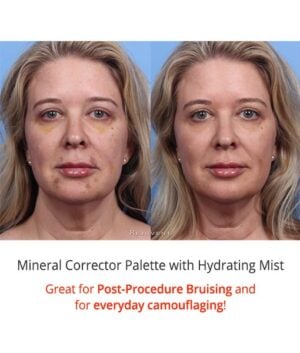 The Best Post-Procedure Camouflaging Cosmetic Mineral Corrector Palette