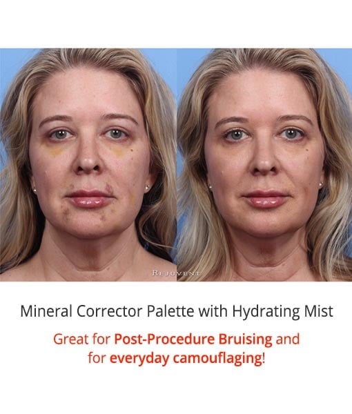 The Best Post-Procedure Camouflaging Cosmetic Mineral Corrector Palette