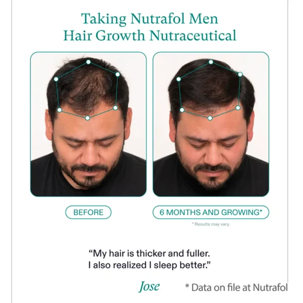 Nutrafol for Men before and after