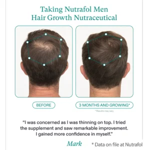 Nutrafol for Men before and after