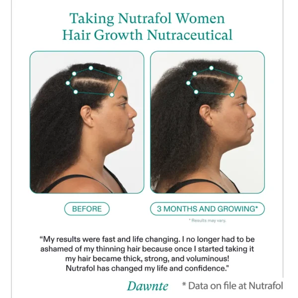 Nutrafol for Women's before and after