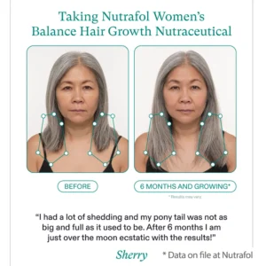 Nutrafol for Women's Balance before and after