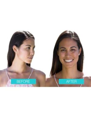 Before and after models with sunless face tanner