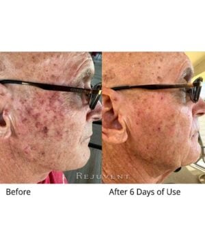 wow Results using SkinNectar
