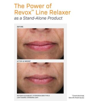 Revox Line Relaxer before and after
