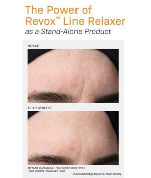 Revox Line Relaxer before and after image 1