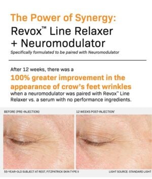 Revox Line Relaxer before and after image 2