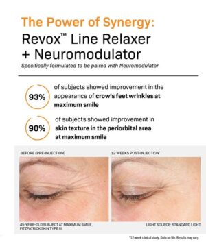 Revox Line Relaxer before and after image 3