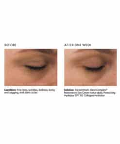 PCA Skin Ideal Complex Revitalizing Eye Gel before and after 2