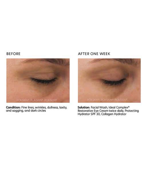 PCA Skin Ideal Complex Revitalizing Eye Gel before and after 2