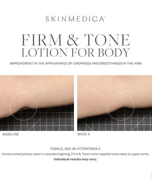 SkinMedica Firm & Tone Lotion results 1