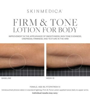 SkinMedica Firm & Tone Lotion results 2